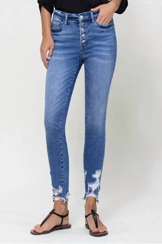 Holly Exposed Button Skinny Jean In Medium Wash